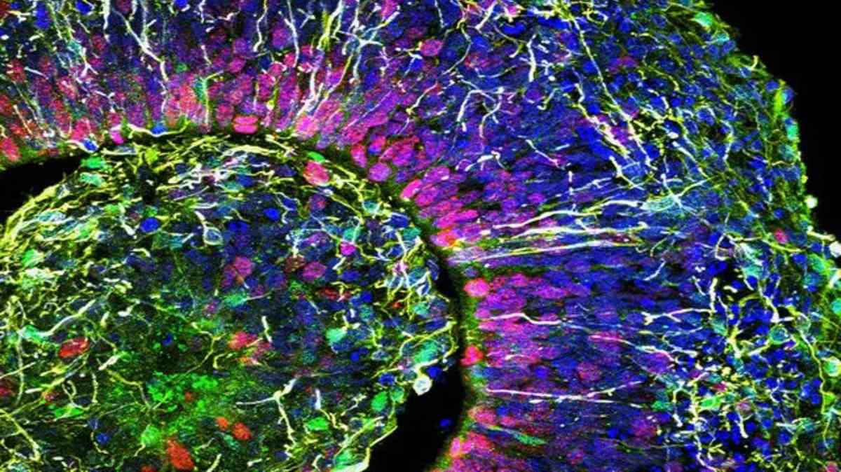 Mini Brains Created From Stem Cells Bioedge