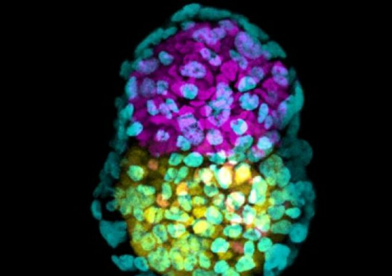 Why are scientists boasting of creating 'synthetic human embryos'? BioEdge